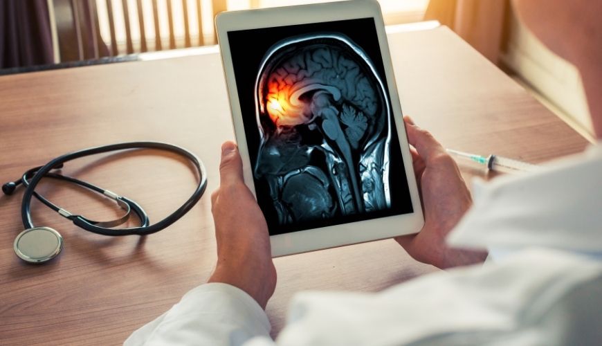 Metge amb una radiografia d'un cervell a la tauleta