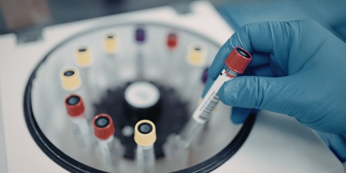 Proves de laboratori