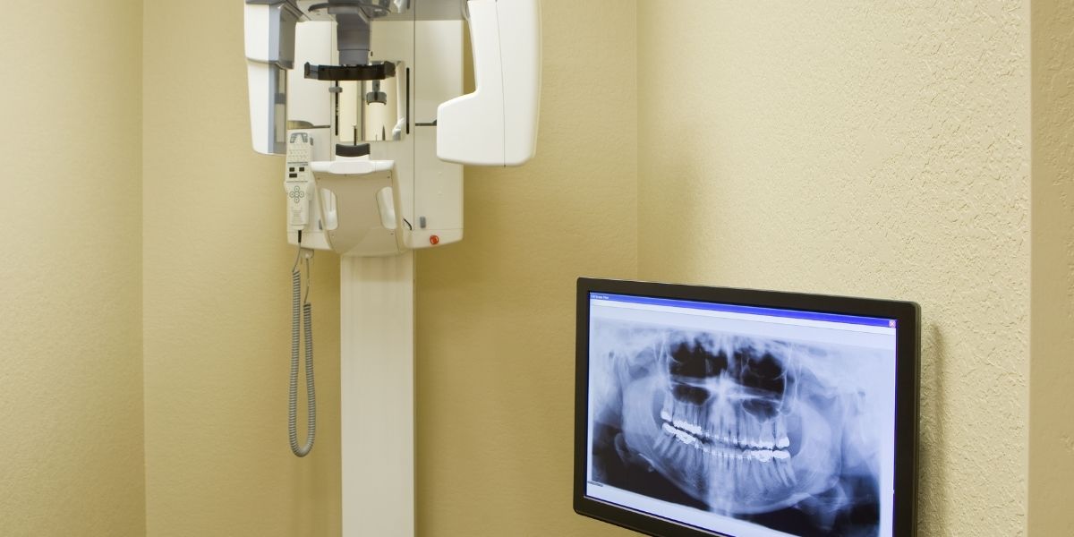 Maxilofacial