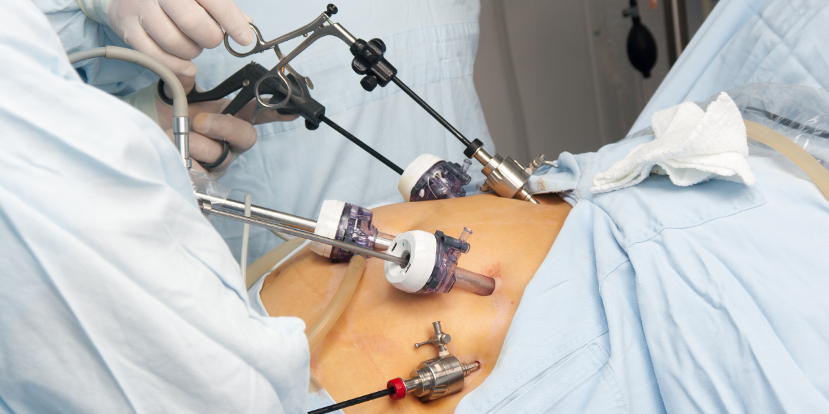 Cirurgia Endocrina, Metabòlica i Bariàtrica