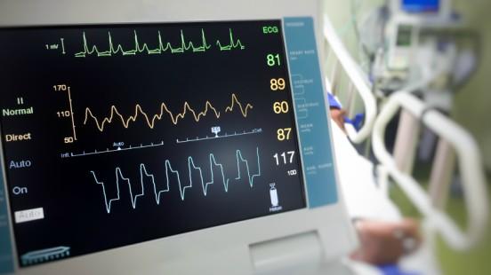 Posesión Sin eco Electrocardiograma | Hospital Universitario Vall d'Hebron