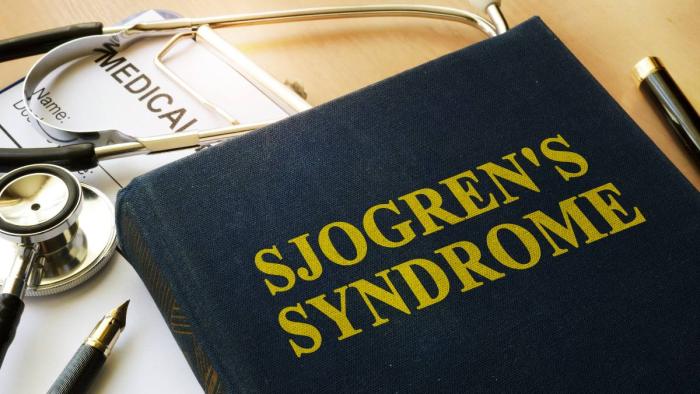 Sindrome Sjogren