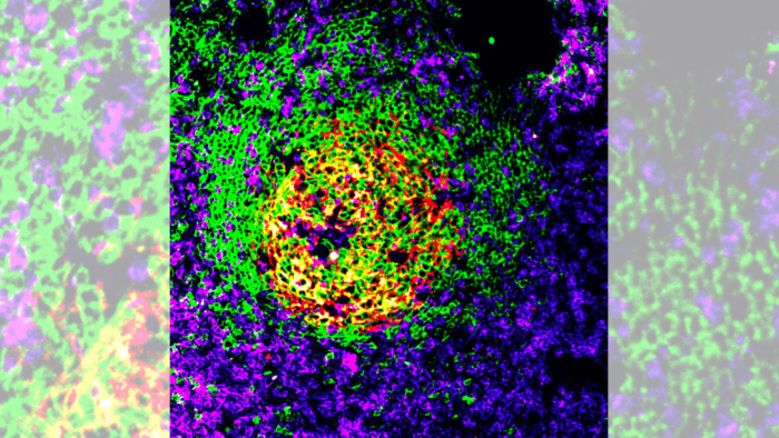 Fotografia a través de microscopi del virus del VIH
