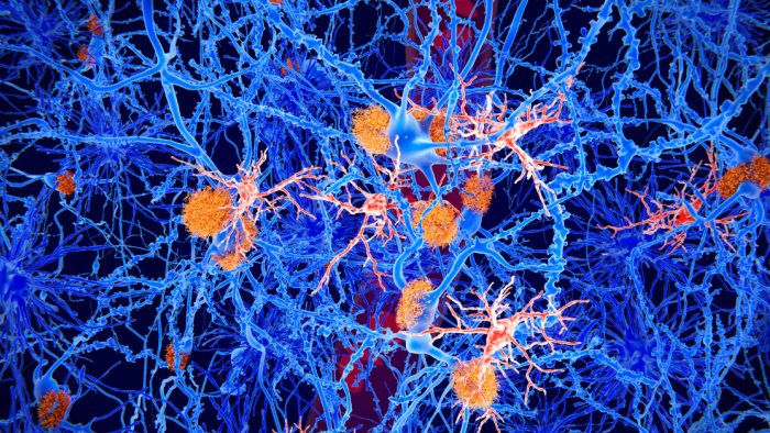 Neurones afectades per Paraparèsies espàstiques hereditàries