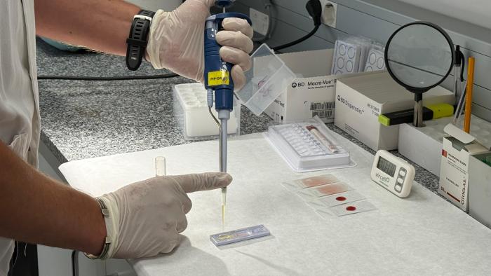 Dengue laboratori