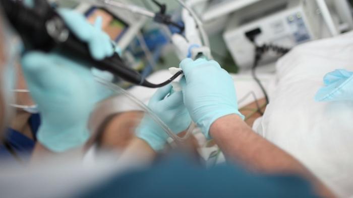 broncoscopia flexible