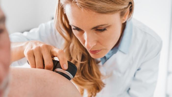 Doctora evaluant un càncer de pell