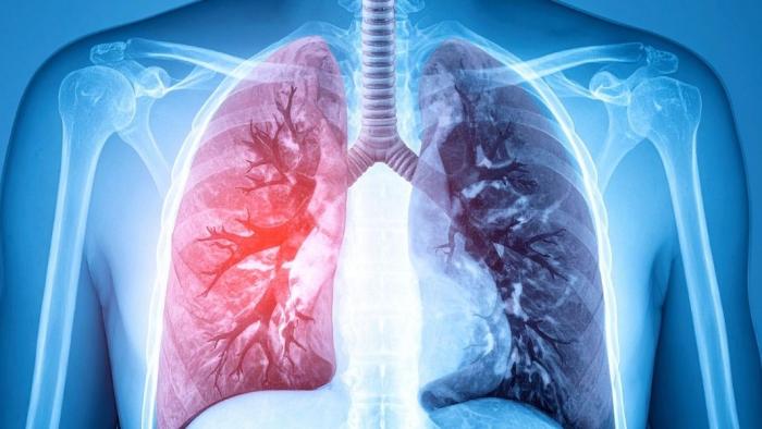 Imatge d'uns pulmons
