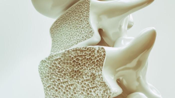 Columna amb osteoporosi