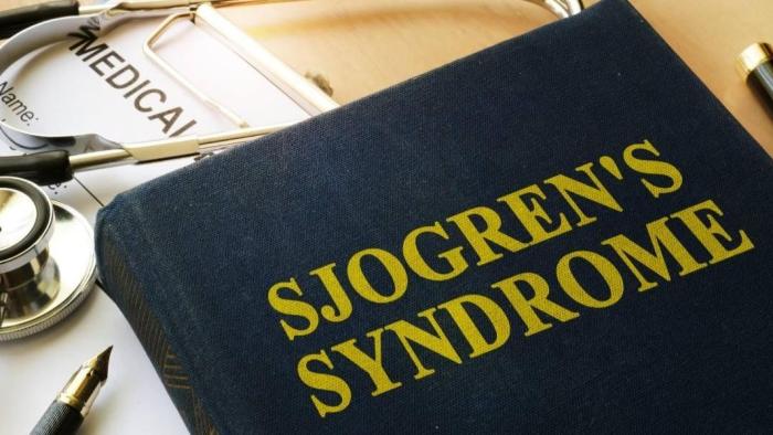 Síndrome de Sjögren