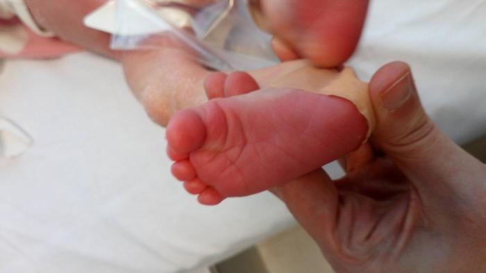 Seguiment Programa de Cribratge Neonatal