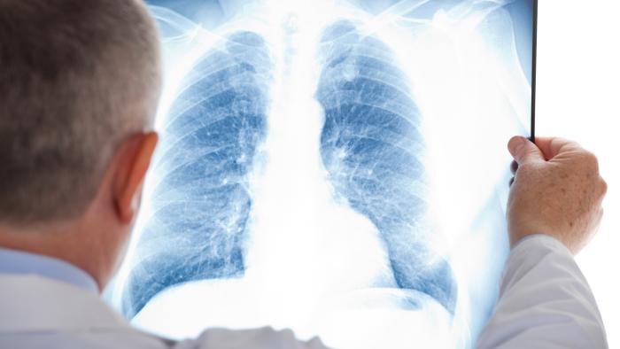 L'atrèsia pulmonar amb comunicació intraventricular a Vall d'Hebron
