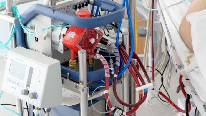 ECMO
