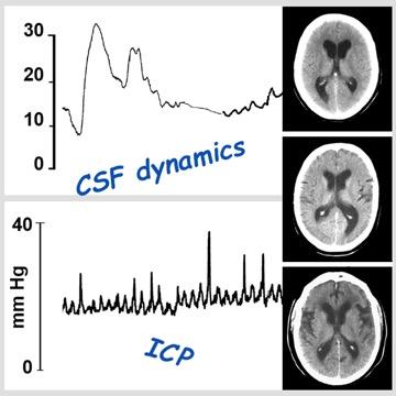 csf