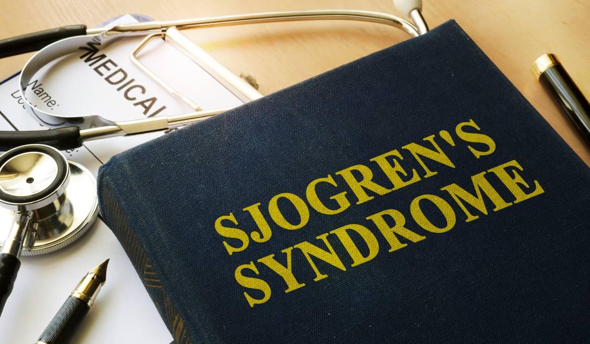 Sindrome Sjogren