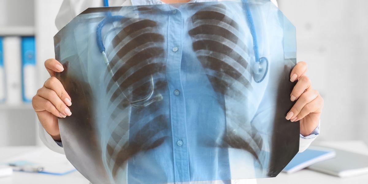 Metgessa amb una radiografia pulmonar