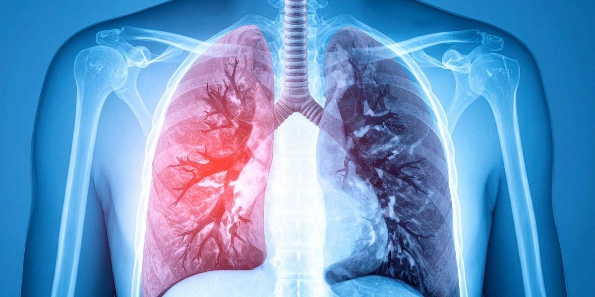 Imatge d'uns pulmons