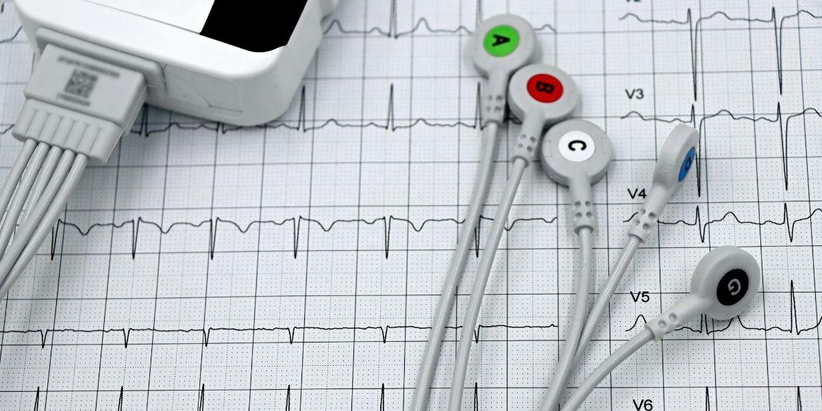 Electrocardiograma