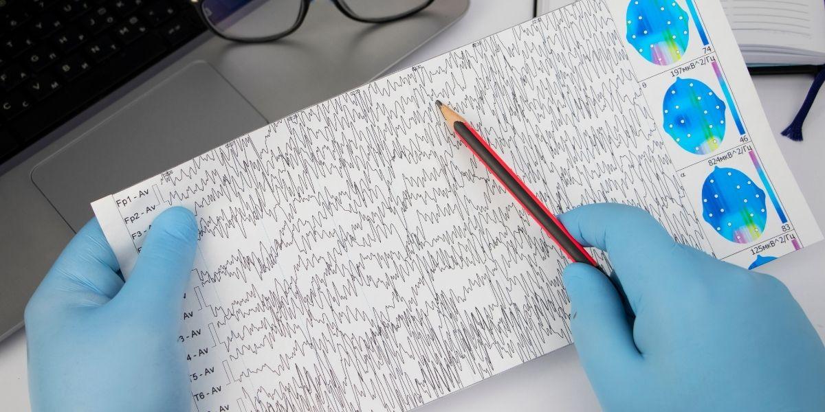 Electroencefalograma