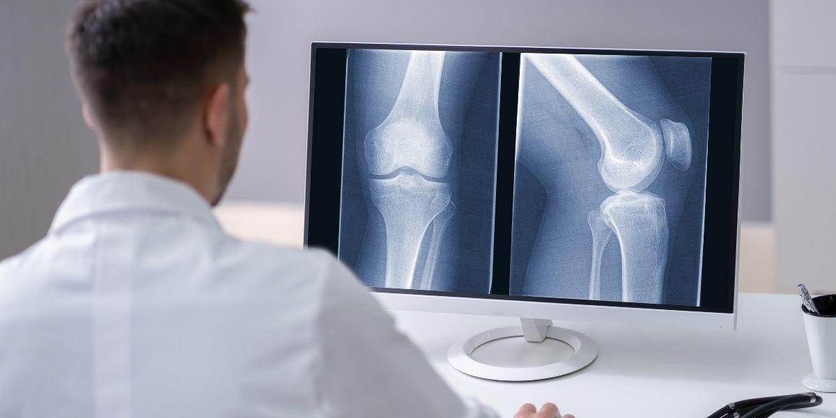 Metge mirant una radiografia