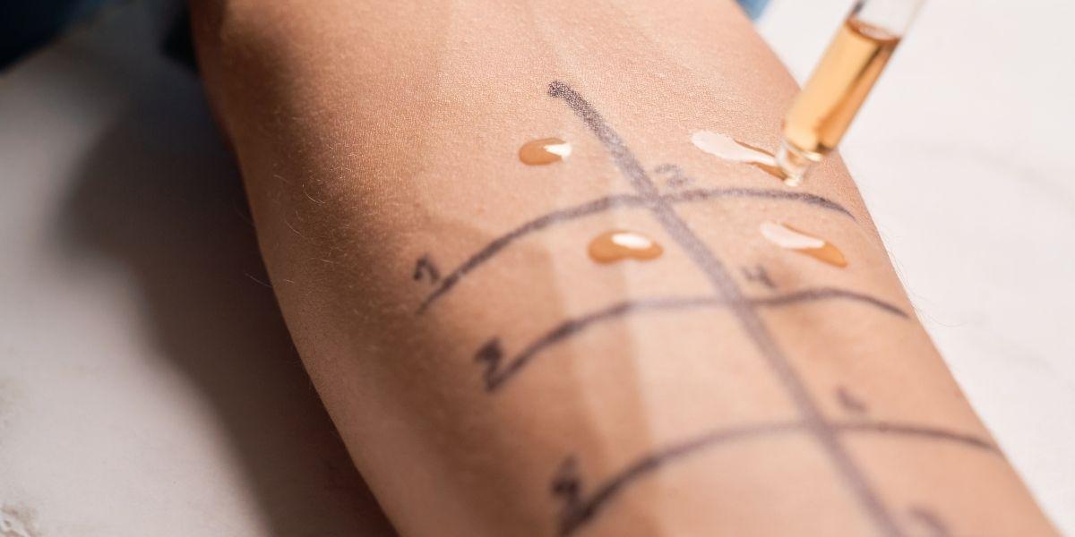 Proves d'al·lèrgens