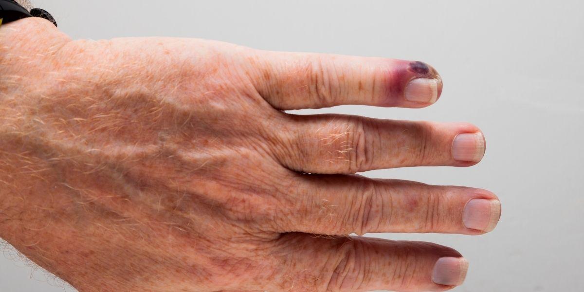 Dit amb començament sèptic