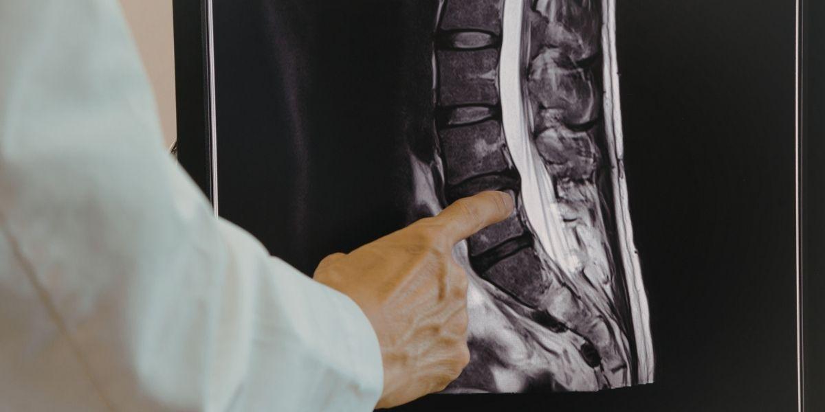 Radiografia d'una esquena