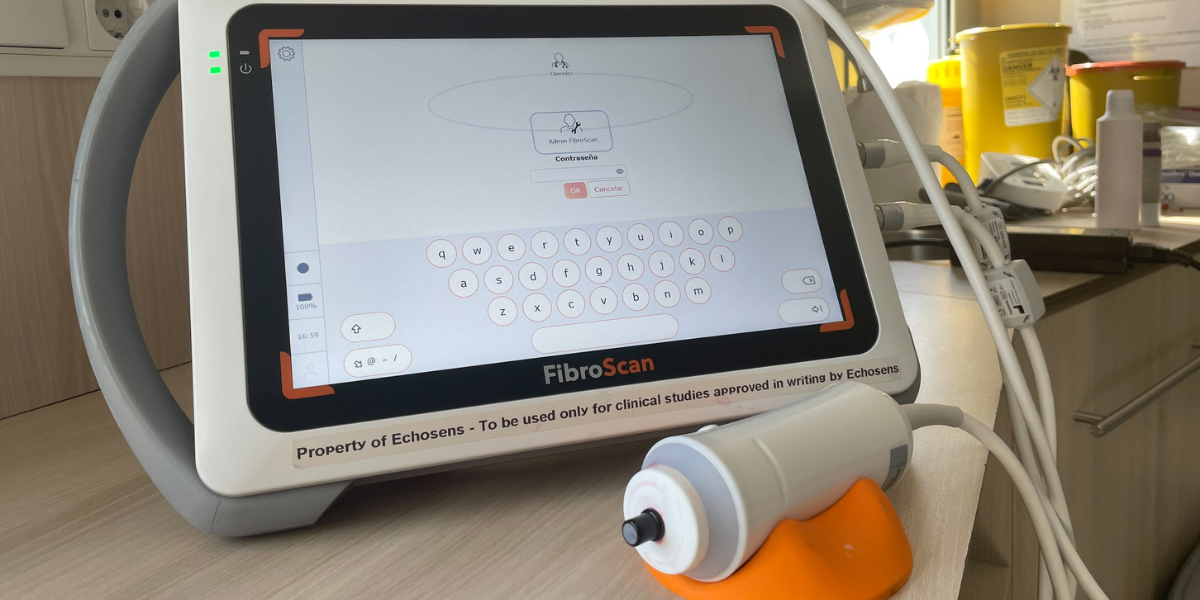 FibroScan